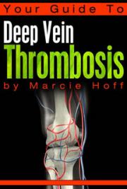 Your Guide to Deep Vein Thrombosis