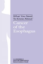 What You Need To Know About™ Cancer of the Esophagus