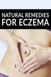 Natural Remedies for Eczema