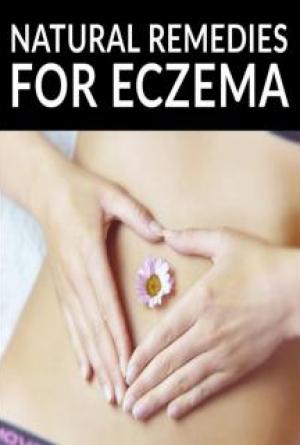 Natural Remedies for Eczema: Holistic Solutions for Healthy Skin
