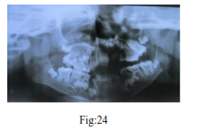 img80.png