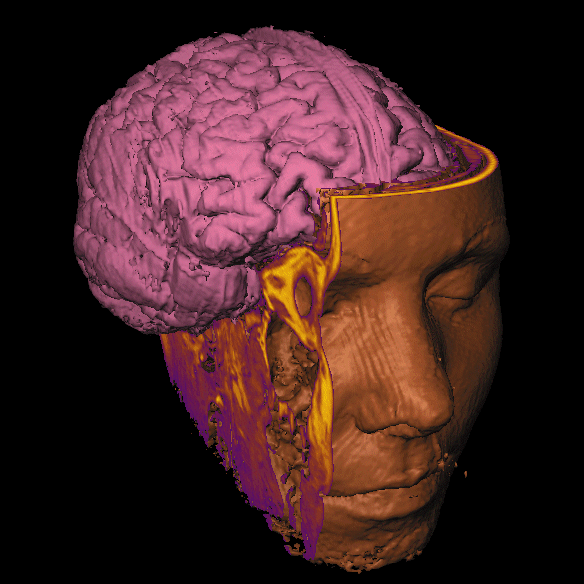 img60.png